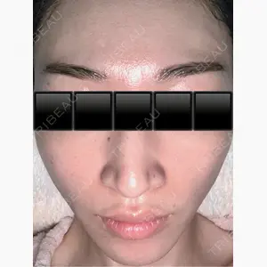 東京シルククリニック 東京神田院口コミ