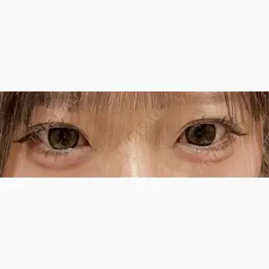 R Beauty CLINIC 銀座院口コミ