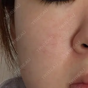 BISIN GINZA CLINIC口コミ