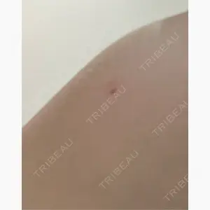 吉祥寺アイビークリニック口コミ