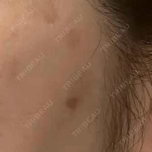 ルラ美容クリニック 東京駅前院口コミ