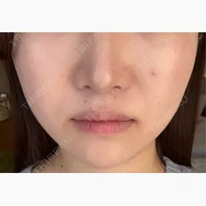 新宿美容外科ネビュラクリニック口コミ