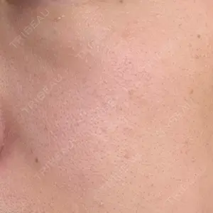 小倉美容外科/美容皮膚科 ビラビューティークリニック口コミ