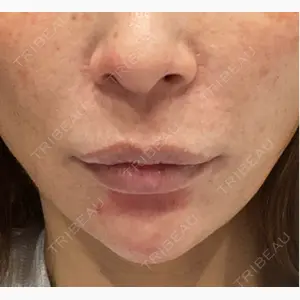 フィラークリニック 名古屋栄院口コミ