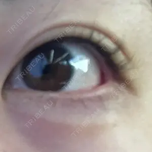 ルラ美容クリニック 静岡院口コミ