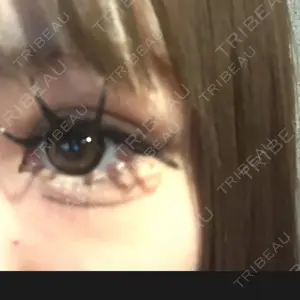 東京シンデレラ美容外科 池袋院口コミ