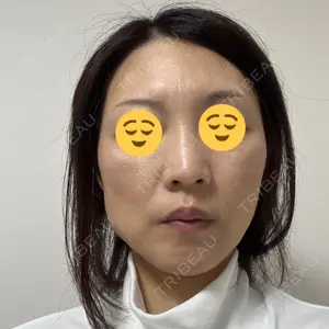 TCB東京中央美容外科 神戸院口コミ