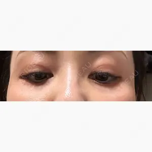 TCB東京中央美容外科 三島院口コミ