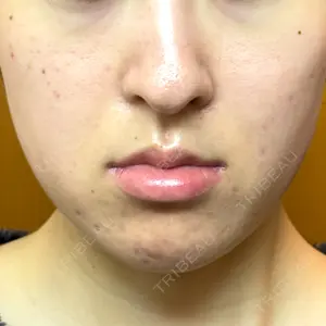 ルラ美容クリニック 郡山院口コミ