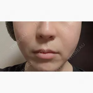 ルラ美容クリニック 大宮院 / ルラスキンクリニック 大宮院口コミ