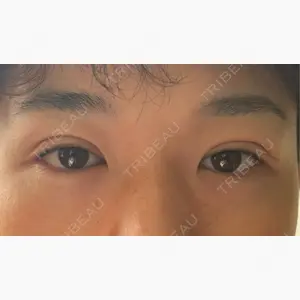 アリエル美容クリニック 大宮院口コミ