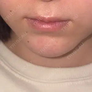 栄美容クリニック 栄院口コミ