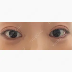 HAAB×DREAM BEAUTY CLINIC 大阪梅田院口コミ