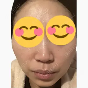 美容皮膚科エルムクリニック 麻布院口コミ