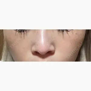 ルラ美容クリニック 仙台院 / ルラスキンクリニック 仙台院口コミ