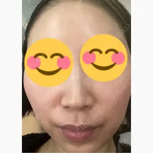 美容皮膚科エルムクリニック 麻布院口コミ