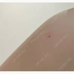 美容皮膚科エルムクリニック 麻布院口コミ