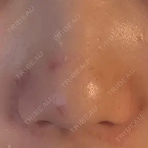 ルラ美容クリニック 池袋院口コミ