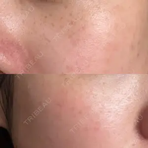 ルラ美容クリニック 札幌本院口コミ