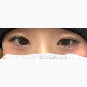 フィラークリニック 福岡院口コミ