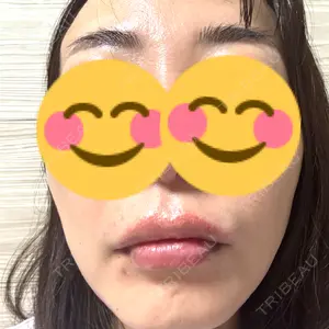 渋谷美容外科クリニック 池袋院口コミ