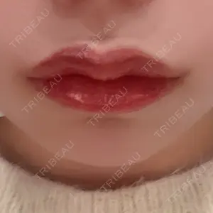 フィラークリニック 新宿院口コミ