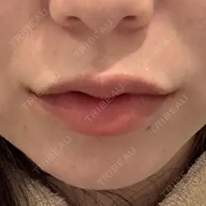 TCB東京中央美容外科 大宮東口院口コミ