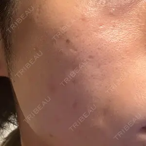 ゆきスキンクリニック 東池袋口コミ