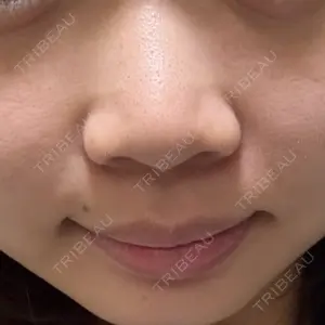 共立美容外科 新宿本院口コミ