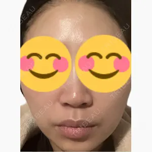 美容皮膚科エルムクリニック 麻布院口コミ