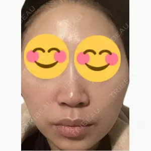 美容皮膚科エルムクリニック 麻布院口コミ