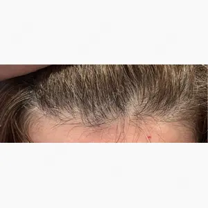 銀座総合美容クリニック口コミ