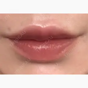 L‘amour clinic Tokyo【ラムールクリニック東京】口コミ