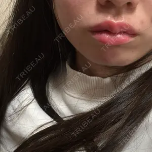 L‘amour clinic Tokyo【ラムールクリニック東京】口コミ