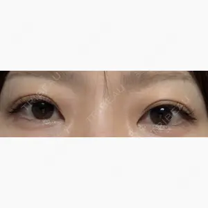 サラ美容外科口コミ