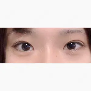 フィラークリニック 渋谷院口コミ