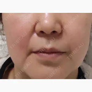 ビューティー和心クリニック 浅草院口コミ