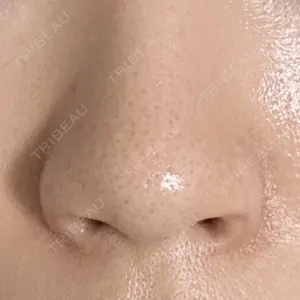 シエルクリニック口コミ