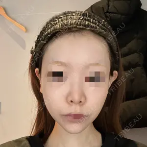 美容皮膚科エルムクリニック 麻布院口コミ