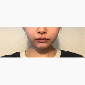 Ledian Clinic六本木口コミ