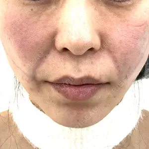 APスキンクリニック銀座口コミ