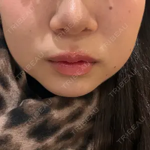 ルラ美容クリニック 渋谷本院口コミ