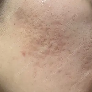 ルラ美容クリニック 広島院口コミ