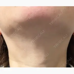 美容皮膚科エルムクリニック 大阪院口コミ