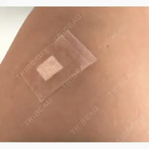 美容皮膚科エルムクリニック 麻布院口コミ