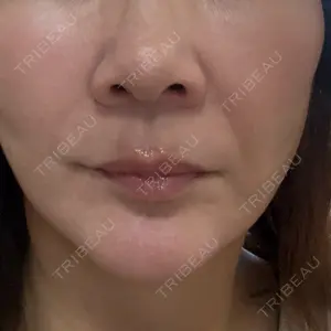 Re:anne clinic 銀座 【リアンクリニック銀座】口コミ