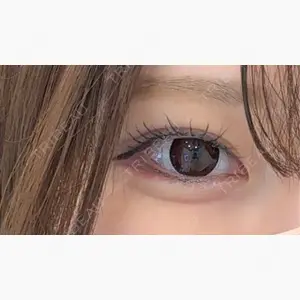 アリエル美容クリニック 大宮院口コミ