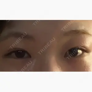 ルラ美容クリニック 大阪心斎橋院口コミ