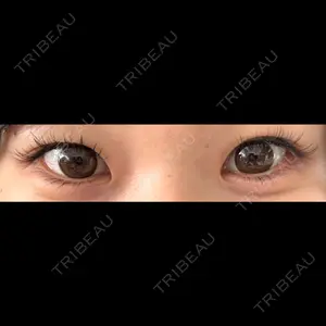 共立美容外科 京都院口コミ