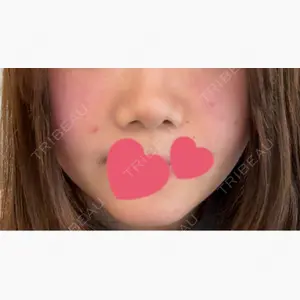 LIFIX BEAUTY CLINIC口コミ